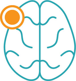 Physio For Neurological Conditions Central Coast
