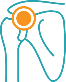 Shoulder Physio Central Coast